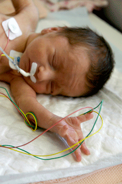 Premature Infant with various monitors attached
