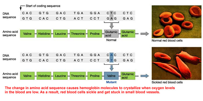 Sickle Cell Coding and Blood Cells. The change in amino acid sequence.  SCD is the medical abbreviation